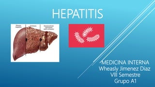 HEPATITIS
MEDICINA INTERNA
Wheasly Jimenez Diaz
Vlll Semestre
Grupo A1
 
