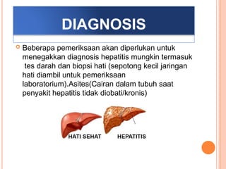 DIAGNOSIS
 Beberapa pemeriksaan akan diperlukan untuk
menegakkan diagnosis hepatitis mungkin termasuk
tes darah dan biopsi hati (sepotong kecil jaringan
hati diambil untuk pemeriksaan
laboratorium).Asites(Cairan dalam tubuh saat
penyakit hepatitis tidak diobati/kronis)
 