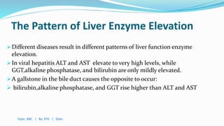 The Pattern of Liver Enzyme Elevation
Different diseases result in different patterns of liver function enzyme
elevation.
In viral hepatitis ALT and AST elevate to very high levels, while
GGT,alkaline phosphatase, and bilirubin are only mildly elevated.
A gallstone in the bile duct causes the opposite to occur:
 bilirubin,alkaline phosphatase, and GGT rise higher than ALT and AST
Topic: ABC | By: EFG | Date:
 