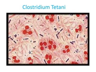 Clostridium Tetani
 