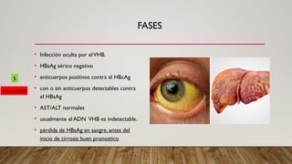FASES
• Infección oculta por elVHB.
• HBsAg sérico negativo
• anticuerpos positivos contra el HBcAg
• con o sin anticuerpos detectables contra
el HBsAg
• AST/ALT normales
• usualmente el ADN VHB es indetectable.
• pérdida de HBsAg en sangre, antes del
inicio de cirrosis buen pronostico
5
inmunidad
 