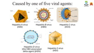 Hepatitis. (HAV, HBV, HCV, HDV, HEV) | PPTX
