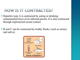 Hepatitis type A is contracted by eating or drinking contaminated feces of an infected person. It is also contracted through unprotected sexual contact.  B and C can be contracted by bodily fluids ( such as semen, and saliva) 
