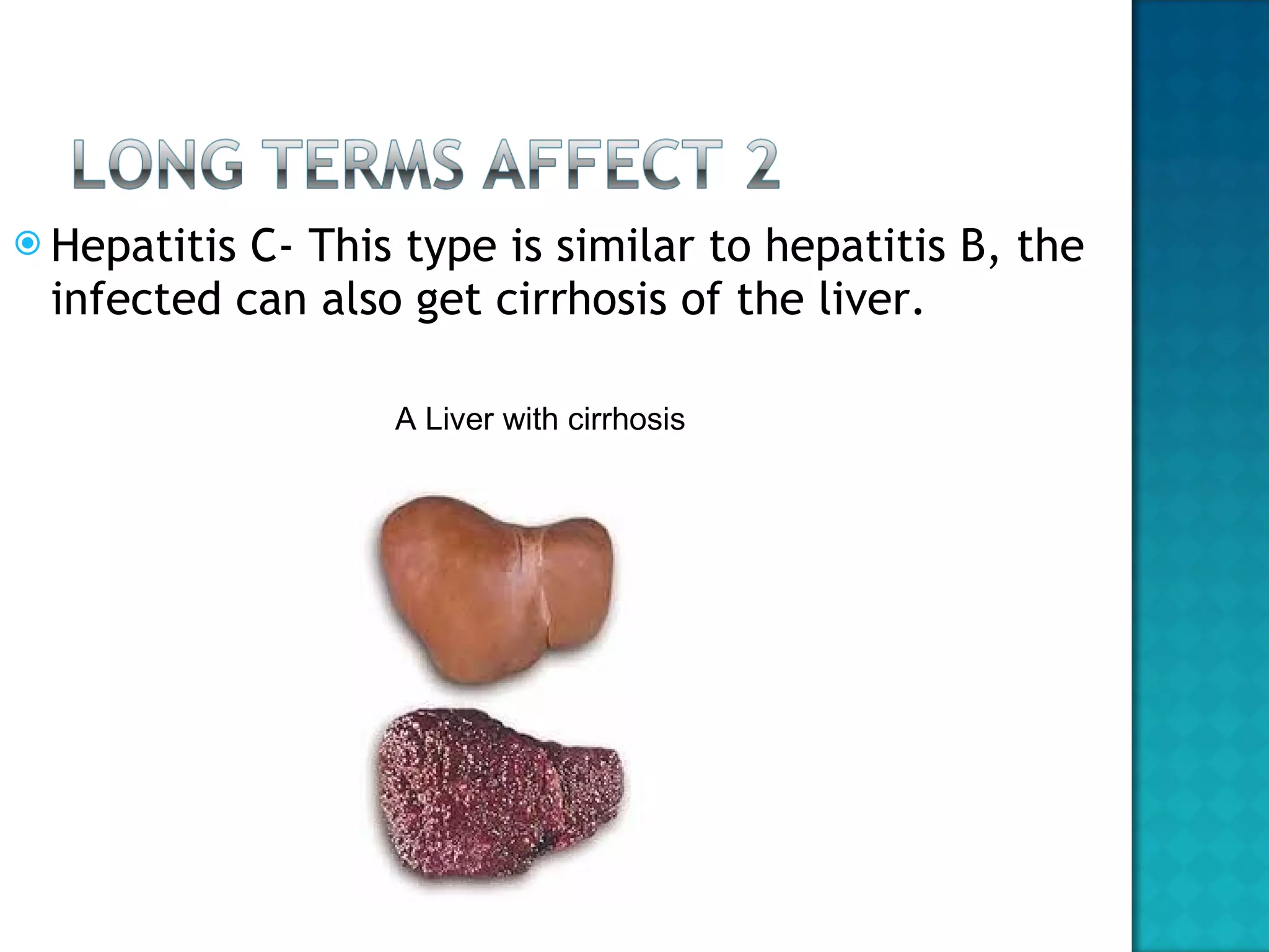 Hepatitis C- This type is similar to hepatitis B, the infected can also get cirrhosis of the liver. A Liver with cirrhosis 
