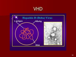 VHD 