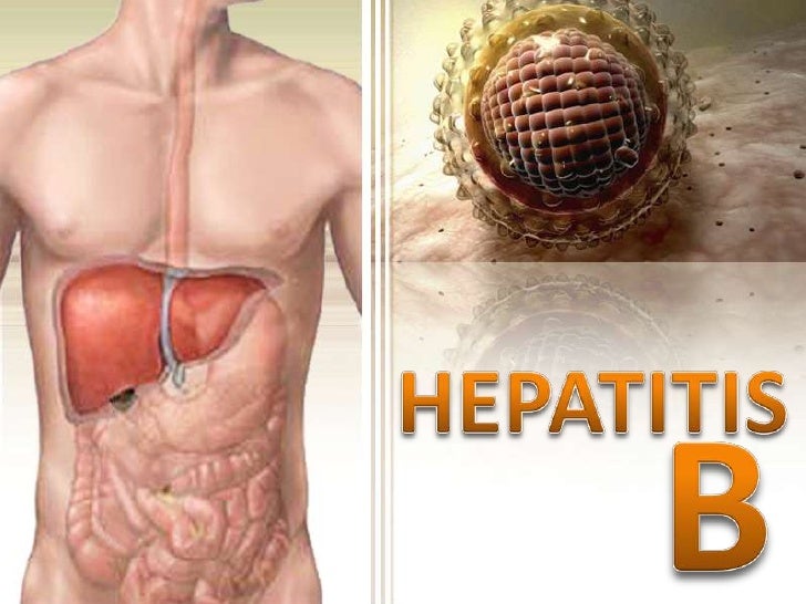 https://image.slidesharecdn.com/hepatitis1-111012134047-phpapp01/95/hepatitis-b-1-728.jpg?cb=1318426914