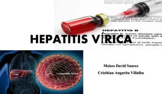 HEPATITIS VÍRICA 
Moises David Suarez 
Cristhian Angarita Villalba 
 
