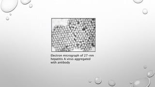 Electron micrograph of 27-nm
hepatitis A virus aggregated
with antibody
 