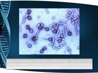 Electron microscopic presentation of HBV particles. The round 42 nm
 Electron microscopic presentation of HBV particles. The round 42 nm
particles represent infectious virions (Dane particle). The small empty
 particles represent infectious virions (Dane particle). The small empty
spheres and the filaments are non infectious.
 spheres and the filaments are non infectious.
 