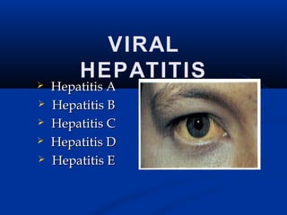 VIRAL
HEPATITIS
 Hepatitis AHepatitis A
 Hepatitis BHepatitis B
 Hepatitis CHepatitis C
 Hepatitis DHepatitis D
 Hepatitis EHepatitis E
 