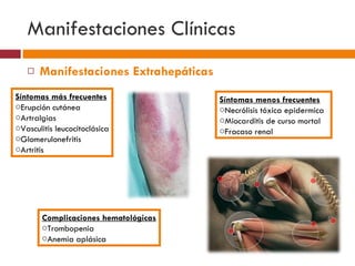 Manifestaciones Clínicas Manifestaciones Extrahepáticas Síntomas más frecuentes Erupción cutánea Artralgias Vasculitis leucocitoclásica Glomerulonefritis Artritis Síntomas menos frecuentes Necrólisis tóxica epidermica Miocarditis de curso mortal Fracaso renal Complicaciones hematológicas Trombopenia Anemia aplásica 