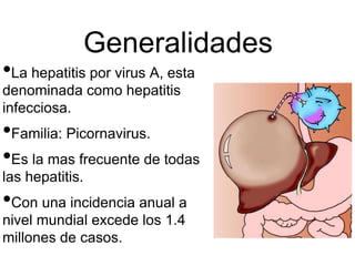 Generalidades
•La hepatitis por virus A, esta
denominada como hepatitis
infecciosa.
•Familia: Picornavirus.
•Es la mas frecuente de todas
las hepatitis.
•Con una incidencia anual a
nivel mundial excede los 1.4
millones de casos.
 