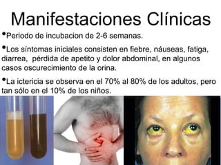 Manifestaciones Clínicas
•Periodo de incubacion de 2-6 semanas.
•Los síntomas iniciales consisten en fiebre, náuseas, fatiga,
diarrea, pérdida de apetito y dolor abdominal, en algunos
casos oscurecimiento de la orina.
•La ictericia se observa en el 70% al 80% de los adultos, pero
tan sólo en el 10% de los niños.
 