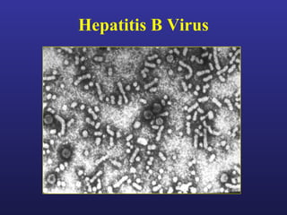 Hepatitis B Virus
 