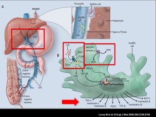 Lucey M et al. N Engl J Med 2009;360:2758-2769
 