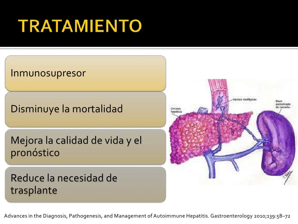 Hepatitis autoinmune