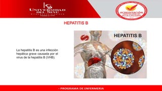 La hepatitis B es una infección
hepática grave causada por el
virus de la hepatitis B (VHB).
 