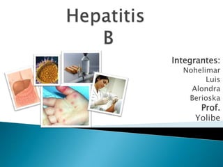 Hepatitis B Integrantes: Nohelimar Luis Alondra Berioska Prof. Yolibe 