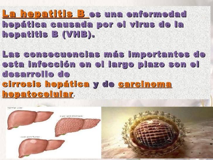 Hepatitis b Hepatitis b