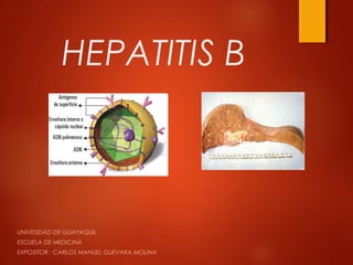 HEPATITIS B



UNIVESIDAD DE GUAYAQUIL
ESCUELA DE MEDICINA
EXPOSITOR : CARLOS MANUEL GUEVARA MOLINA
 