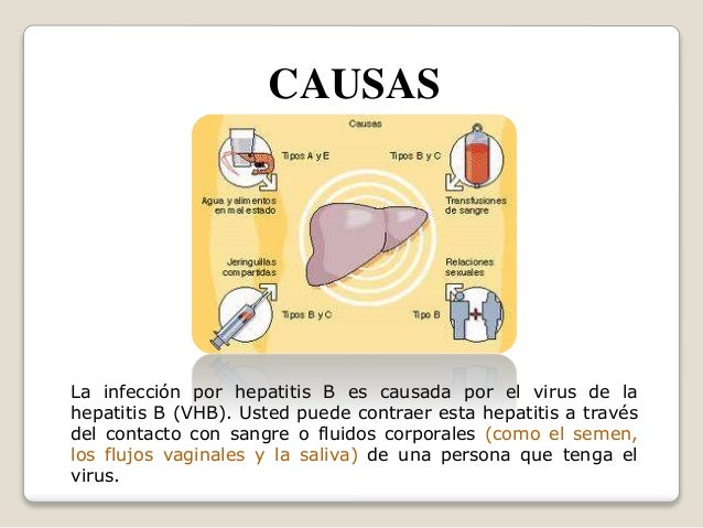 Hepatitis b Hepatitis b