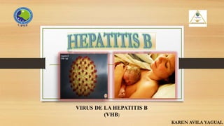 KAREN AVILA YAGUAL
VIRUS DE LA HEPATITIS B
(VHB)
 