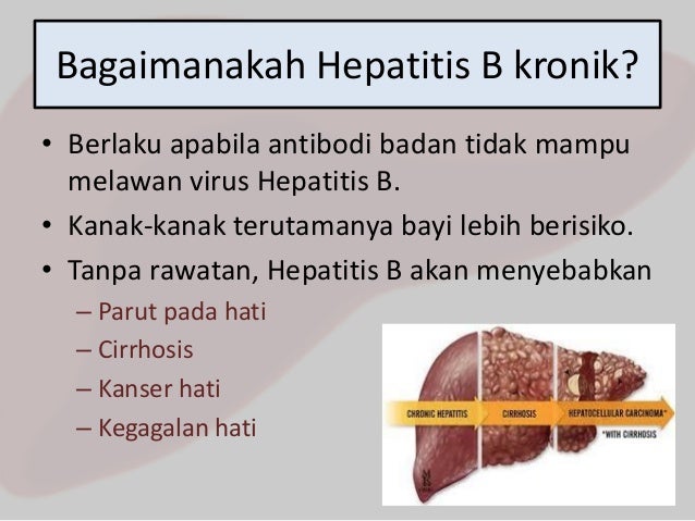 SCE1064 Hepatitis B