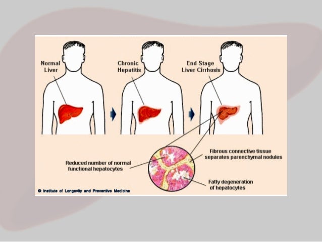 SCE1064 Hepatitis B