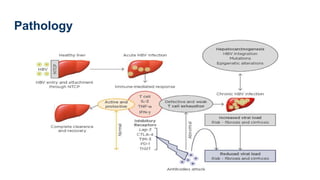 Hepatitis b general medicine powerpoint.. | PPTX