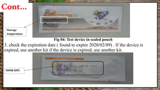 3. check the expiration date ( found to expire 2020/02/09) . If the device is
expired, use another kit if the device is expired, use another kit.
Storage
temperature
Fig 04: Test device in sealed pouch
Cont…
.
EXPIRE DATE
 