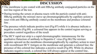DISCUSSION
 The membrane is pre coated with anti HBsAg antibody conjugated particles on the
test line region of the test.
 During testing the serum or plasma reacts with the particle coated with anti-
HBsAg antibody the mixture move up chromatographically by capillary action to
react with anti HBsAg antibody coated on the membrane and produce coloured
line .
 The presence which indicate positive test (Fig.07) while it is absence indicate a
negative results (Fig.09) a coloured line appears in the control region serving as
procedure control regardless of the result
 The HCV rapid test strip is a rapid chromatographic immunoassay for the
qualitative Detection of antibody to Hepatitis C virus (Fig.06).The mixture
migrates upward on the membrane chromatographically by capillary action to react
with recombinant HCV Antigen on the membrane and generate a colored line; the
presence of this colored line indicates a positive result (Fig.09). While its absence
indicates negative result, a colored line will always appear at the control line..
 