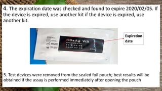 Expiration
date
4. The expiration date was checked and found to expire 2020/02/05. If
the device is expired, use another kit if the device is expired, use
another kit.
5. Test devices were removed from the sealed foil pouch; best results will be
obtained if the assay is performed immediately after opening the pouch
 