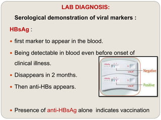 LAB DIAGNOSIS:
Serological demonstration of viral markers :
HBsAg :
 first marker to appear in the blood.
 Being detectable in blood even before onset of
clinical illness.
 Disappears in 2 months.
 Then anti-HBs appears.
 Presence of anti-HBsAg alone indicates vaccination
 