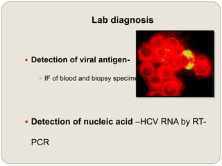 Lab diagnosis
 Detection of viral antigen-
 IF of blood and biopsy specimen
 Detection of nucleic acid –HCV RNA by RT-
PCR
 