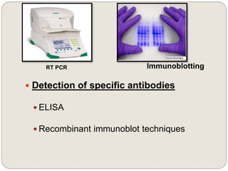 Immunoblotting
 Detection of specific antibodies
 ELISA
 Recombinant immunoblot techniques
RT PCR
 
