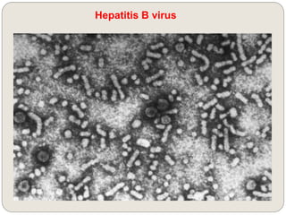 Hepatitis B virus
 