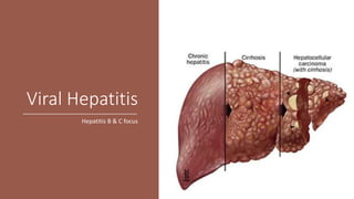 Viral Hepatitis
Hepatitis B & C focus
 