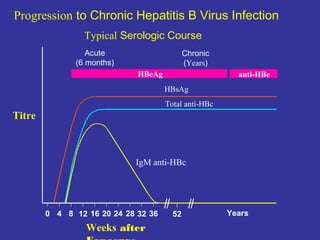 Progression to Chronic Hepatitis B Virus Infection
Typical Serologic Course
Acute
(6 months)

Chronic
(Years)
HBeAg

anti-HBe
HBsAg
Total anti-HBc

Titre

IgM anti-HBc

0 4 8 12 16 20 24 28 32 36

Weeks after

52

Years

 