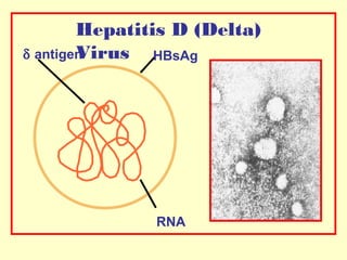 Hepatitis D (Delta)
Virus HBsAg
δ antigen

RNA

 
