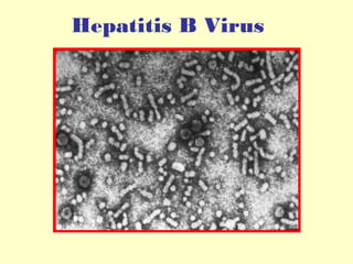 Hepatitis B Virus

 