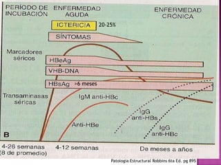 20-25%>6 mesesPatologia Estructural Robbins 6ta Ed. pg 895 