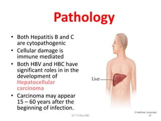 Pathology
• Both Hepatitis B and C
are cytopathogenic
• Cellular damage is
immune mediated
• Both HBV and HBC have
significant roles in in the
development of
Hepatocellular
carcinoma
• Carcinoma may appear
15 – 60 years after the
beginning of infection.
36Dr.T.V.Rao MD
 