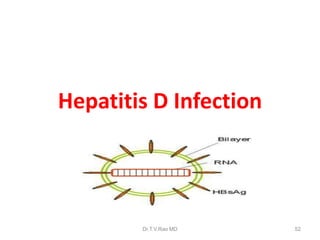 Hepatitis D Infection
Dr.T.V.Rao MD 52
 