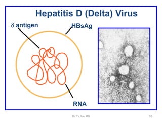 HBsAg
RNA
 antigen
Hepatitis D (Delta) Virus
Dr.T.V.Rao MD 55
 