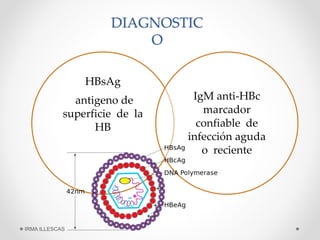 DIAGNOSTIC
O
HBsAg
antigeno de
superficie de la
HB
IgM anti-HBc
marcador
confiable de
infección aguda
o reciente
IRMA ILLESCAS
 