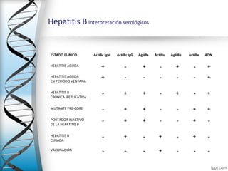 Hepatitis B Interpretación serológicos


ESTADO CLINICO        AcHBc IgM   AcHBc IgG   AgHBs   AcHBs   AgHBe   AcHBe   ADN

HEPATITIS AGUDA           +           -         +       -       +       -     +
HEPATITIS AGUDA           +           -         -       -       -       -     +
EN PERIODO VENTANA

HEPATITIS B               -          +          +       -       +       -     +
CRÓNICA REPLICATIVA

MUTANTE PRE-CORE          -          +          +       -       -      +      +
PORTADOR INACTIVO         -          +          +       -       -      +       -
DE LA HEPATITIS B

HEPATITIS B               -          +          -       +       -      +       -
CURADA

VACUNACIÓN                -           -         -       +       -       -      -
 