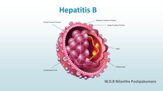Hepatitis B
W.D.R Nilantha Pushpakumara
 