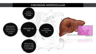 CARCINOMA HEPATOCELULAR
Desarrollo de
CHC
Lesiones
específicas en
el hígado
80% de los CHC
asociados a VHB
contienen el ADN
viral integrado
Potenciadores o
los promotores,
podrian actuar en
cis y activar un
oncogén
Múltiples
funciones del gen
HBx
 