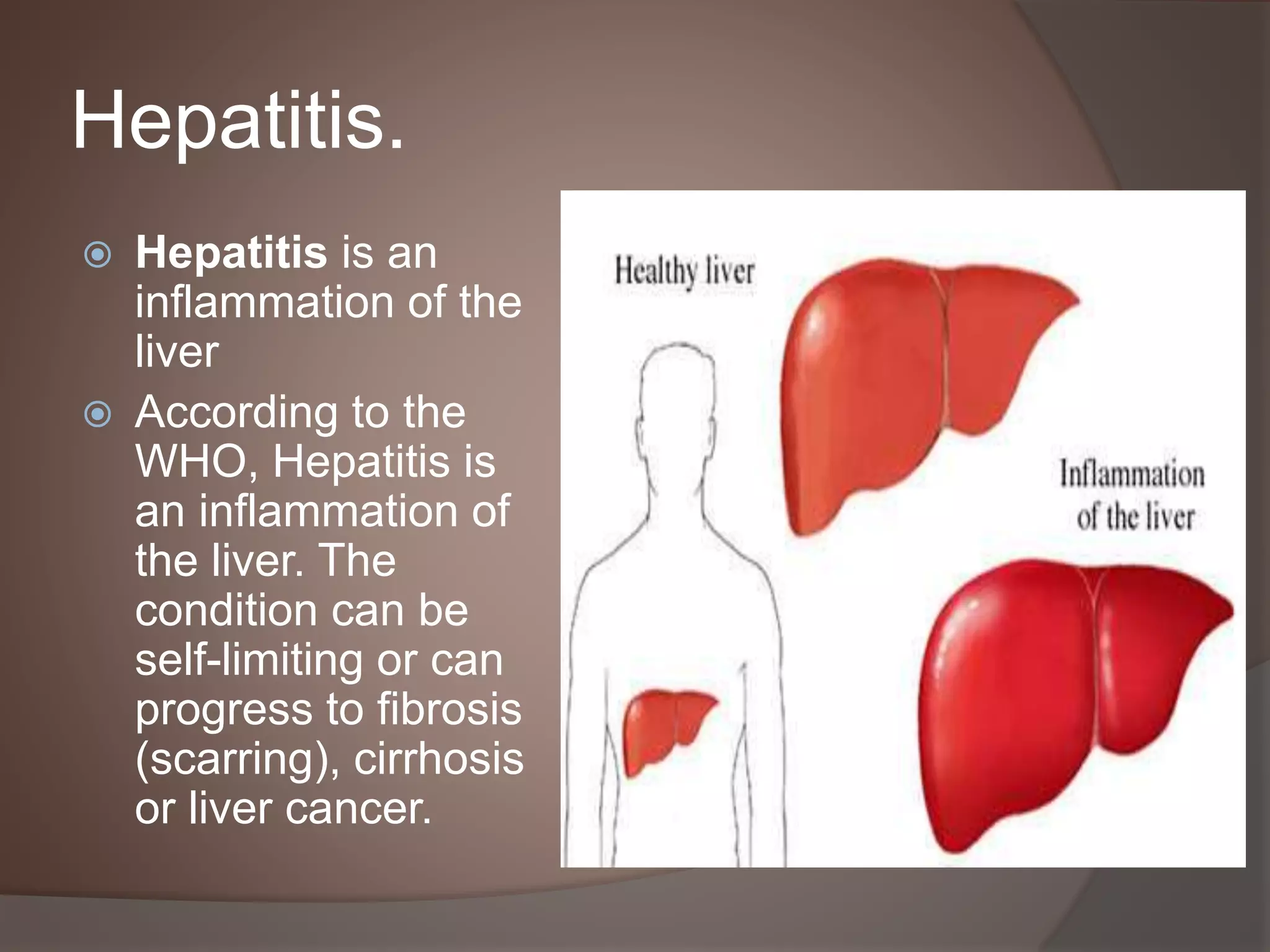 Acute Chronic Hepatitis Sonology Urdu | PPTX
