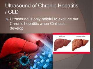 Acute Chronic Hepatitis Sonology Urdu | PPTX